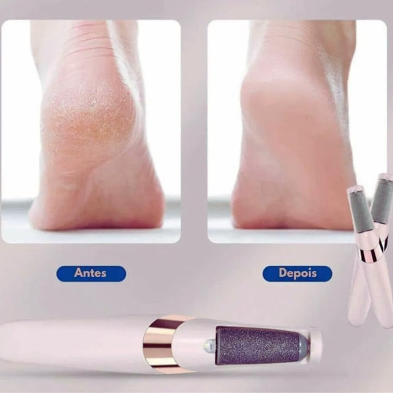 Lixa Lixador de Pé Elétrico Removedor de Calos Para os Pés Portátil Recarregável Lixa Esfoliador Pedicure