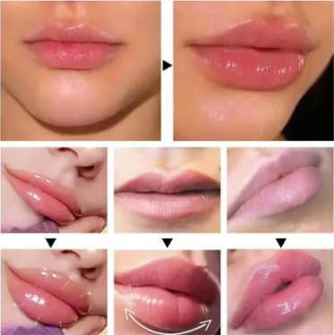 Kit Preenchimento Labial Instantâneo Lip Plumper