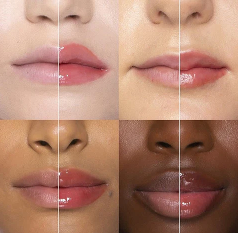 Kit Preenchimento Labial Instantâneo Lip Plumper